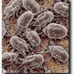 Mighty mites as seen with electron microscopy. They eat more than skin. 