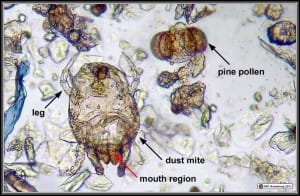 Dust mite, skin, and pollen seen with a light  microscope. Gimmie some skin.