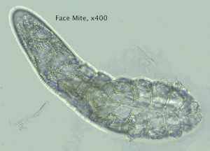 The facial mite movie. They live on in us, about 1 per hair follicle, particularly favoring eyelashes. Whenever you shower, your shower with a friend.